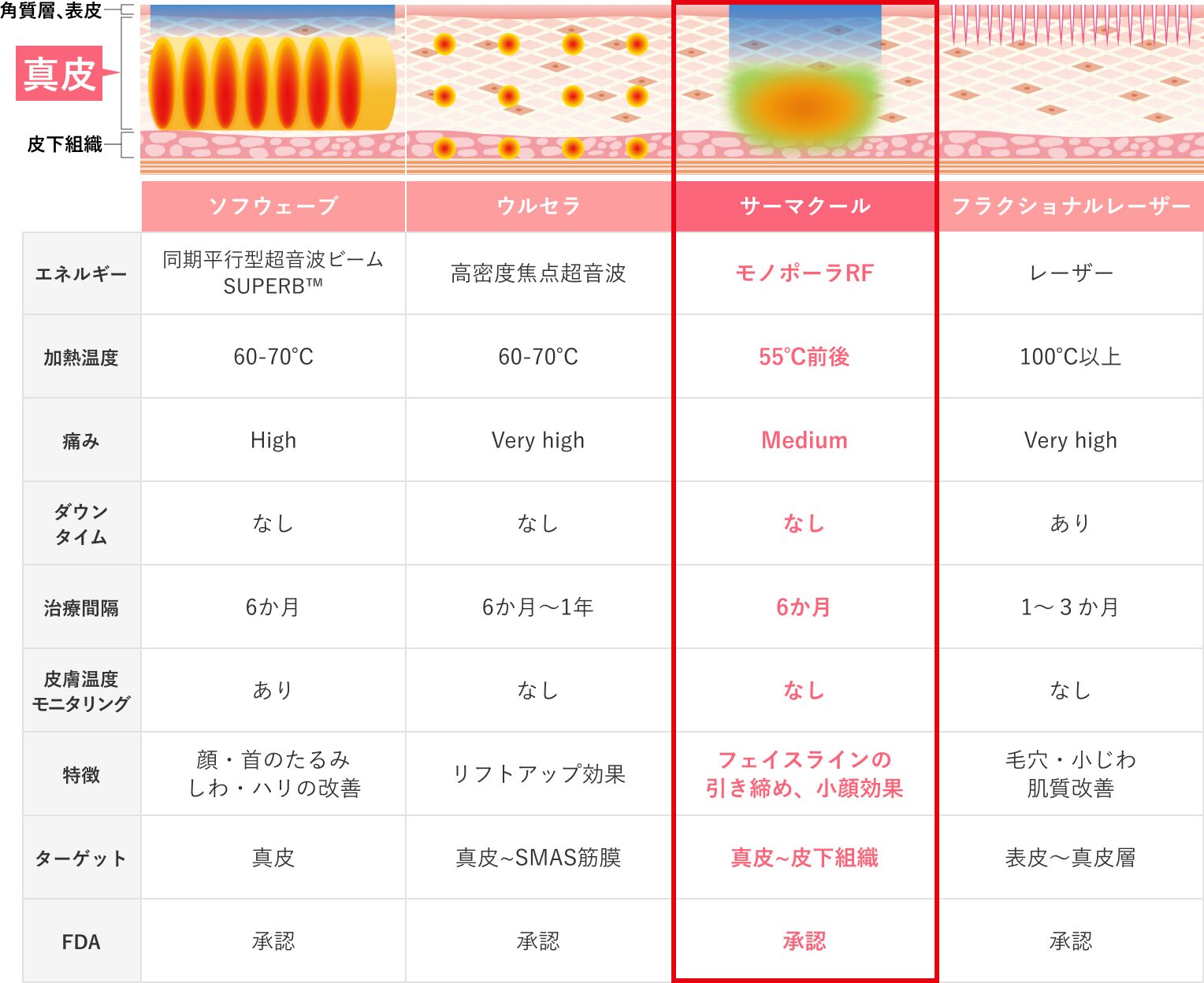 サーマクールFLX/CPT｜美容皮膚科シロノクリニック｜恵比寿院(東京都
